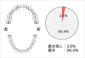 再検査時のお手入れ状況